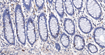 Cyclin A2 Antibody in Immunohistochemistry (Paraffin) (IHC (P))
