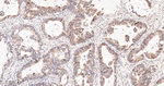 Cyclin A2 Antibody in Immunohistochemistry (Paraffin) (IHC (P))