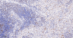 Cyclin A2 Antibody in Immunohistochemistry (Paraffin) (IHC (P))