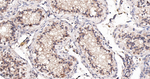 Cyclin A2 Antibody in Immunohistochemistry (Paraffin) (IHC (P))