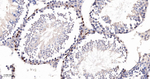 Cyclin A2 Antibody in Immunohistochemistry (Paraffin) (IHC (P))