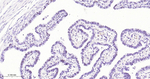 PAX8 Antibody in Immunohistochemistry (Paraffin) (IHC (P))