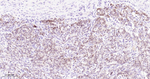 PAX8 Antibody in Immunohistochemistry (Paraffin) (IHC (P))
