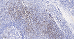CD3d Antibody in Immunohistochemistry (Paraffin) (IHC (P))