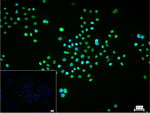 TSG101 Recombinant Rabbit Monoclonal Antibody (6C3)