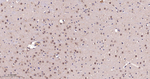 TSG101 Antibody in Immunohistochemistry (Paraffin) (IHC (P))