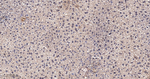 TSG101 Antibody in Immunohistochemistry (Paraffin) (IHC (P))