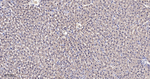TSG101 Antibody in Immunohistochemistry (Paraffin) (IHC (P))