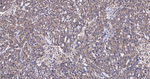 TSG101 Antibody in Immunohistochemistry (Paraffin) (IHC (P))