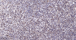 TSG101 Antibody in Immunohistochemistry (Paraffin) (IHC (P))