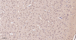 TSG101 Antibody in Immunohistochemistry (Paraffin) (IHC (P))