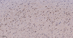 TSG101 Antibody in Immunohistochemistry (Paraffin) (IHC (P))