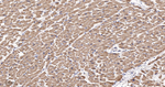 TSG101 Antibody in Immunohistochemistry (Paraffin) (IHC (P))