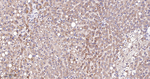 TSG101 Antibody in Immunohistochemistry (Paraffin) (IHC (P))
