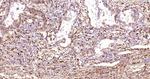 HSP27 Recombinant Rabbit Monoclonal Antibody (7C4)