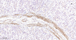 HSP27 Antibody in Immunohistochemistry (Paraffin) (IHC (P))