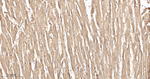 HSP27 Antibody in Immunohistochemistry (Paraffin) (IHC (P))
