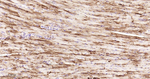 HSP27 Antibody in Immunohistochemistry (Paraffin) (IHC (P))
