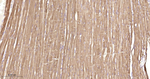 HSP27 Antibody in Immunohistochemistry (Paraffin) (IHC (P))