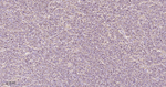 CCR7 Antibody in Immunohistochemistry (Paraffin) (IHC (P))