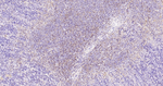 CCR7 Antibody in Immunohistochemistry (Paraffin) (IHC (P))