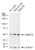 MMP13 Antibody in Western Blot (WB)