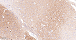 alpha Actinin 2 Antibody in Immunohistochemistry (Paraffin) (IHC (P))