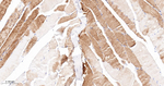 alpha Actinin 2 Recombinant Rabbit Monoclonal Antibody (4C1)