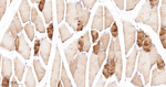 alpha Actinin 2 Antibody in Immunohistochemistry (Paraffin) (IHC (P))