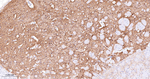 alpha Actinin 2 Antibody in Immunohistochemistry (Paraffin) (IHC (P))