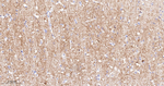 alpha Actinin 2 Antibody in Immunohistochemistry (Paraffin) (IHC (P))