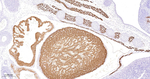 alpha Actinin 2 Antibody in Immunohistochemistry (Paraffin) (IHC (P))