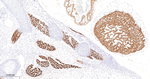 alpha Actinin 2 Antibody in Immunohistochemistry (Paraffin) (IHC (P))