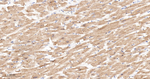 alpha Actinin 2 Antibody in Immunohistochemistry (Paraffin) (IHC (P))