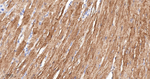 alpha Actinin 2 Antibody in Immunohistochemistry (Paraffin) (IHC (P))