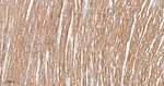 alpha Actinin 2 Antibody in Immunohistochemistry (Paraffin) (IHC (P))