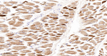 alpha Actinin 2 Antibody in Immunohistochemistry (Paraffin) (IHC (P))