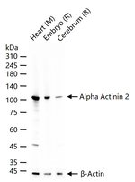 alpha Actinin 2 Antibody in Western Blot (WB)