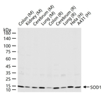SOD1 Antibody in Western Blot (WB)