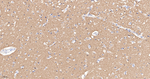 CD56 Antibody in Immunohistochemistry (Paraffin) (IHC (P))