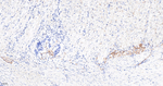 CD56 Antibody in Immunohistochemistry (Paraffin) (IHC (P))
