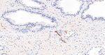 CD56 Antibody in Immunohistochemistry (Paraffin) (IHC (P))