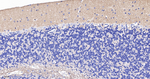 CD56 Antibody in Immunohistochemistry (Paraffin) (IHC (P))