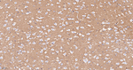 CD56 Antibody in Immunohistochemistry (Paraffin) (IHC (P))