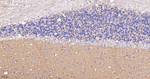 CD56 Antibody in Immunohistochemistry (Paraffin) (IHC (P))
