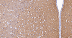 CD56 Antibody in Immunohistochemistry (Paraffin) (IHC (P))