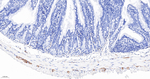 CD56 Antibody in Immunohistochemistry (Paraffin) (IHC (P))