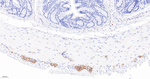 CD56 Antibody in Immunohistochemistry (Paraffin) (IHC (P))