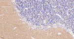 CD56 Antibody in Immunohistochemistry (Paraffin) (IHC (P))