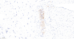 CD56 Antibody in Immunohistochemistry (Paraffin) (IHC (P))